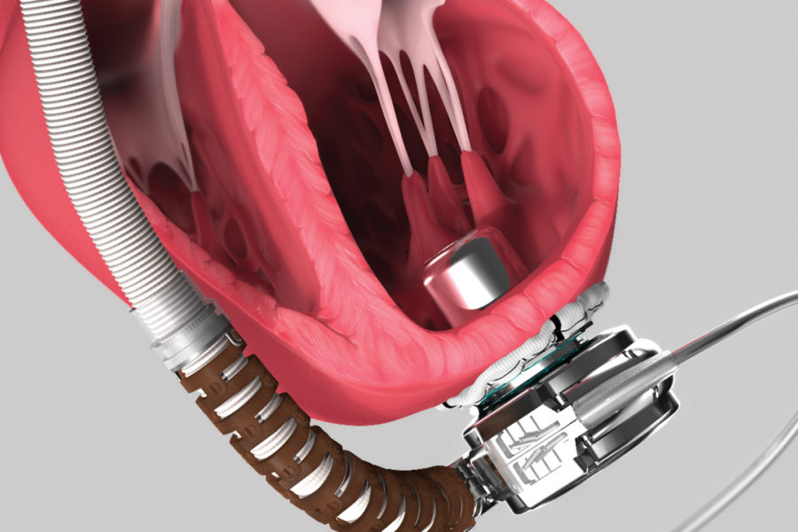 Medical Devices